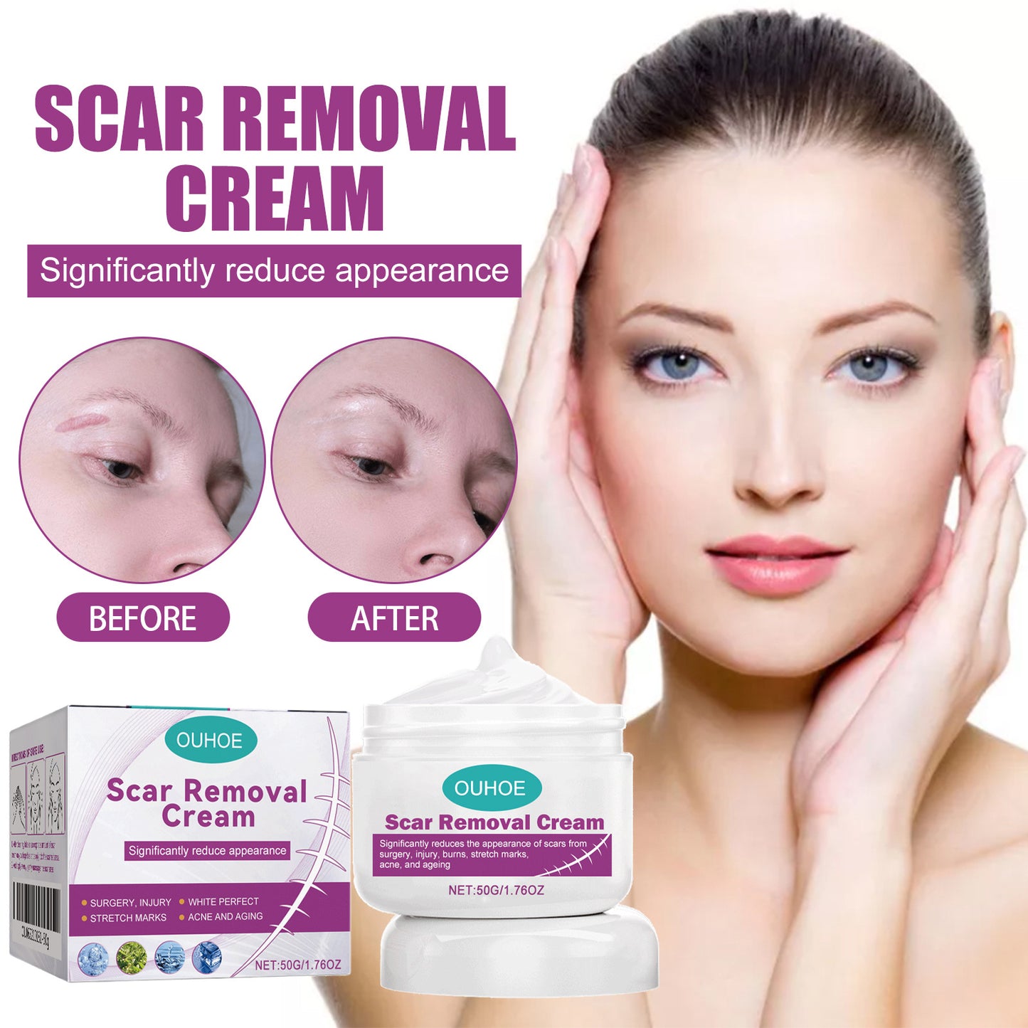 Scar Removal Cream